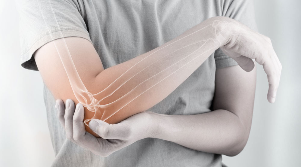prevenir el dolor articular
